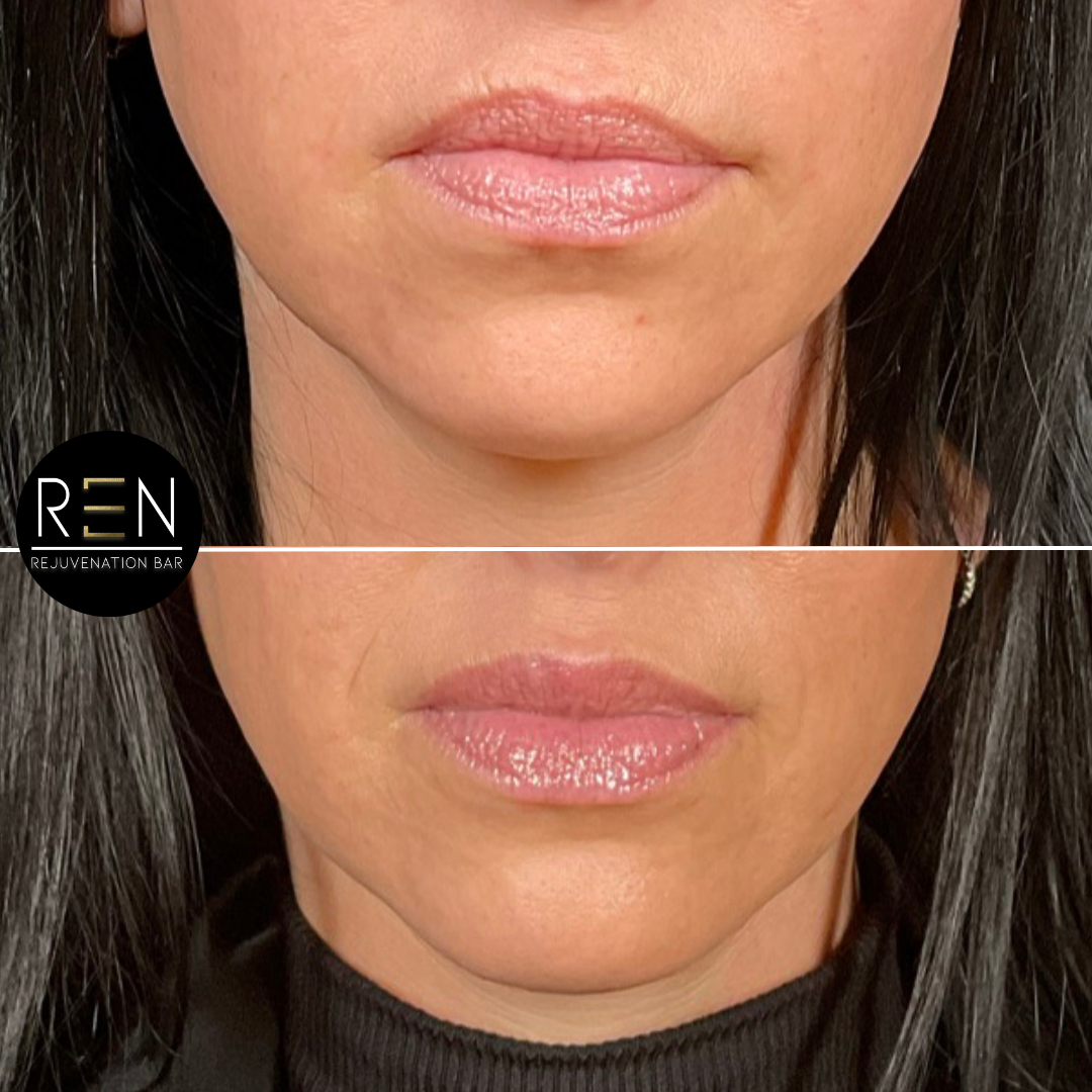 Untitled design.zip - 20.PNG