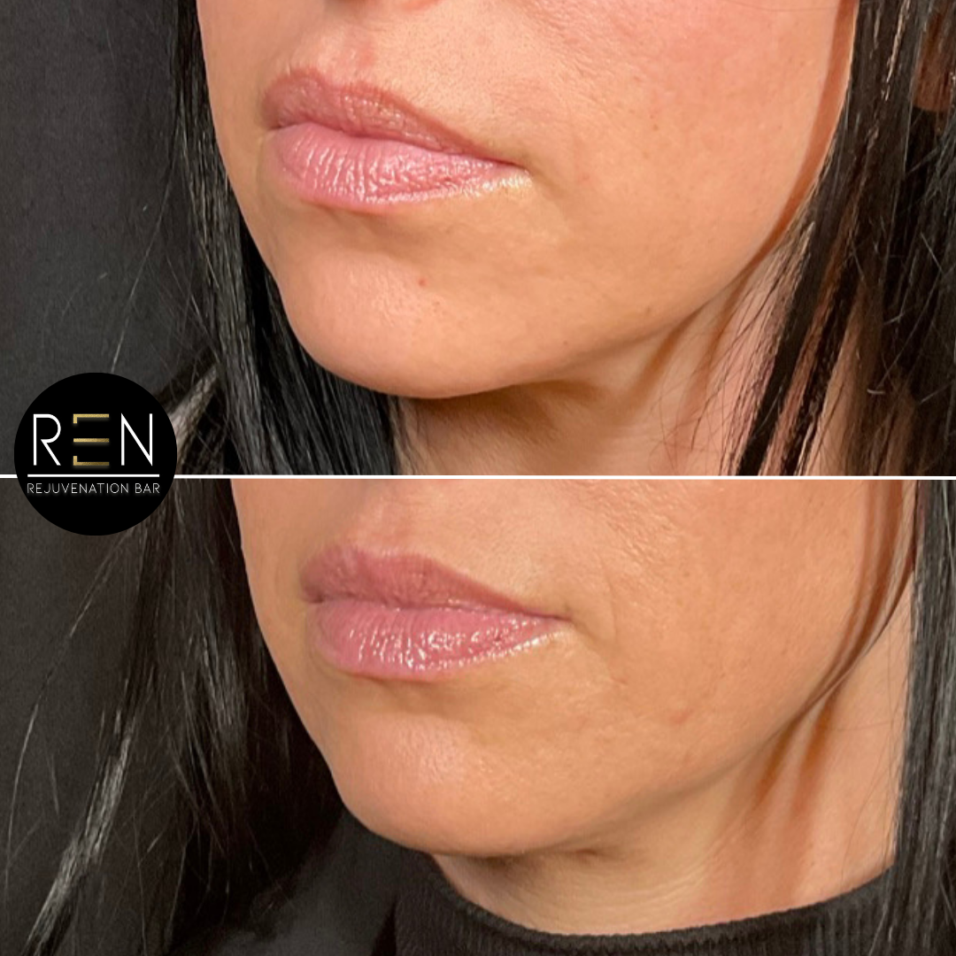 Untitled design.zip - 22.PNG