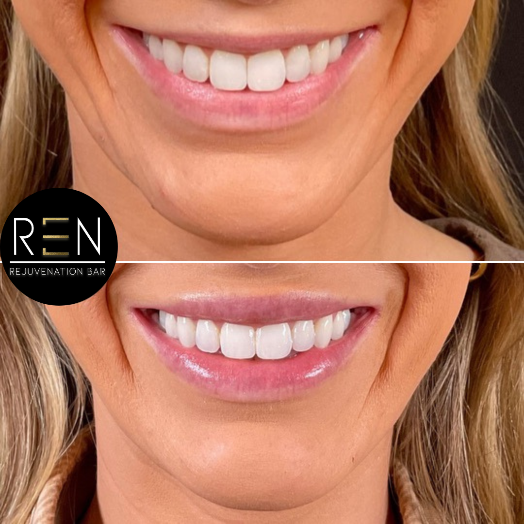 Untitled design 2.png.PNG