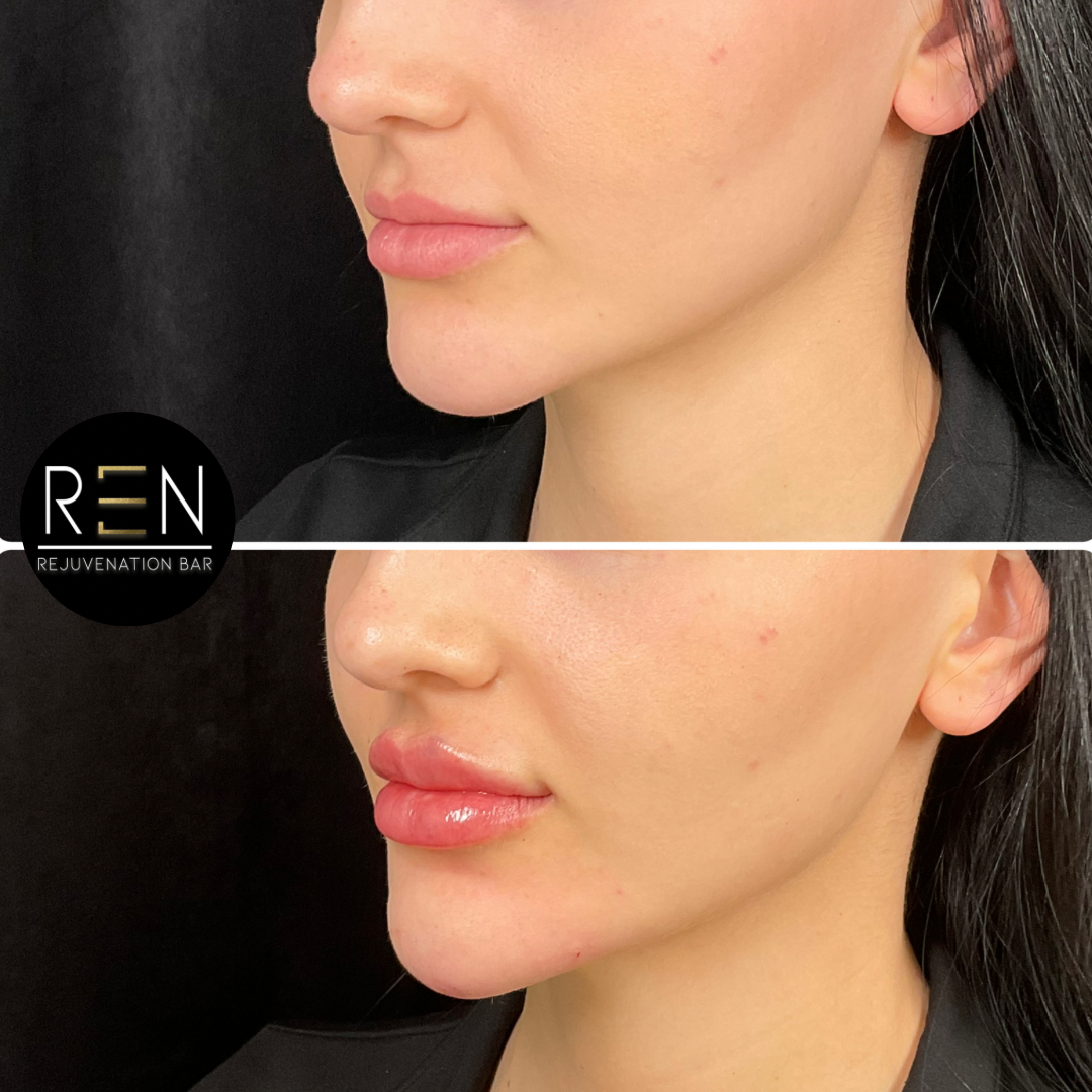 Untitled design - 37.PNG