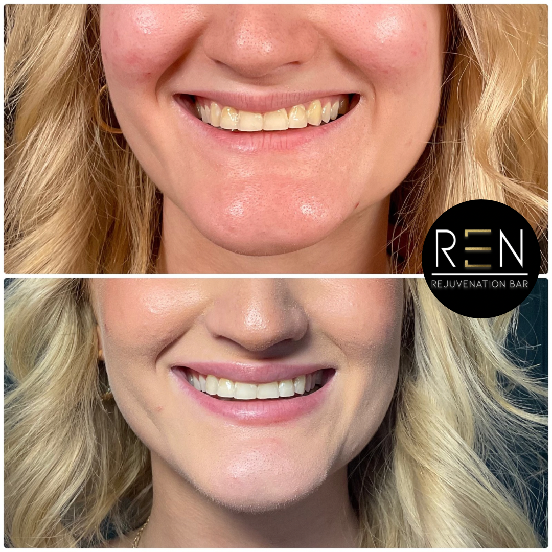 Untitled design - 27.PNG