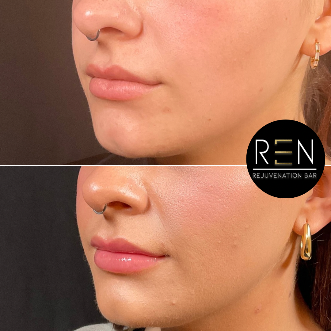 7FDE30FF-B4CB-4BCB-85E8-4A705ABB301A 2.PNG