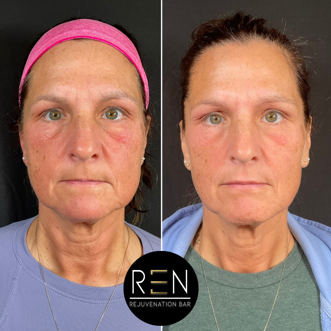 Masseter Tox + Medical Grade Skincare.zip - 1.PNG