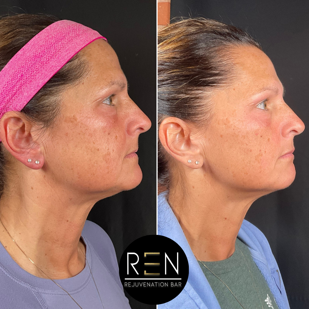 Masseter Tox + Medical Grade Skincare.zip - 6.PNG