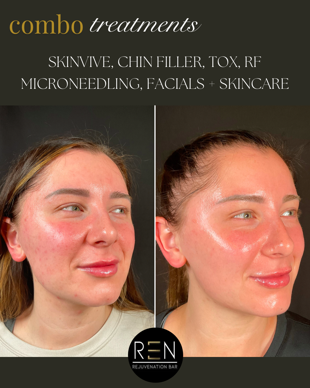 SKINVIVE + MEDICAL GRADE SKINCARE - 1.PNG