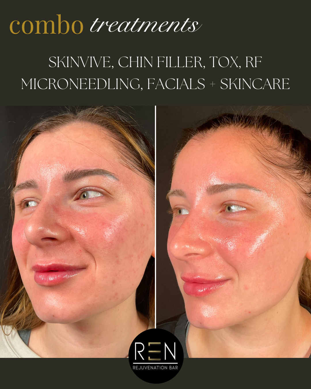 SKINVIVE + MEDICAL GRADE SKINCARE - 2.PNG
