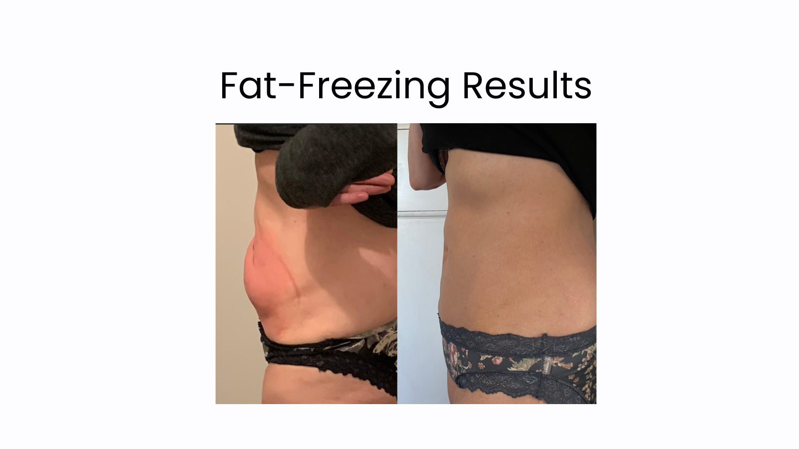When More Isn’t Better: The Power of “Just Enough” Movement for Fat Loss