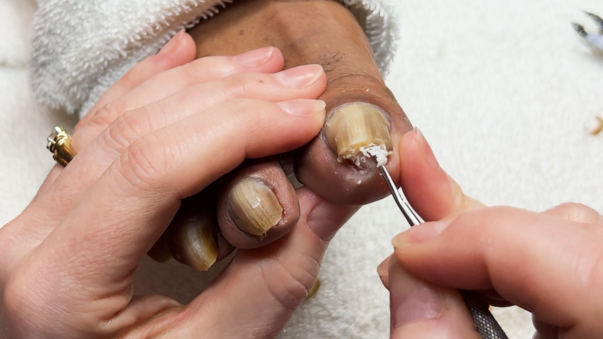Most Common Toenail Problems | The Podiatry Group of South Texas