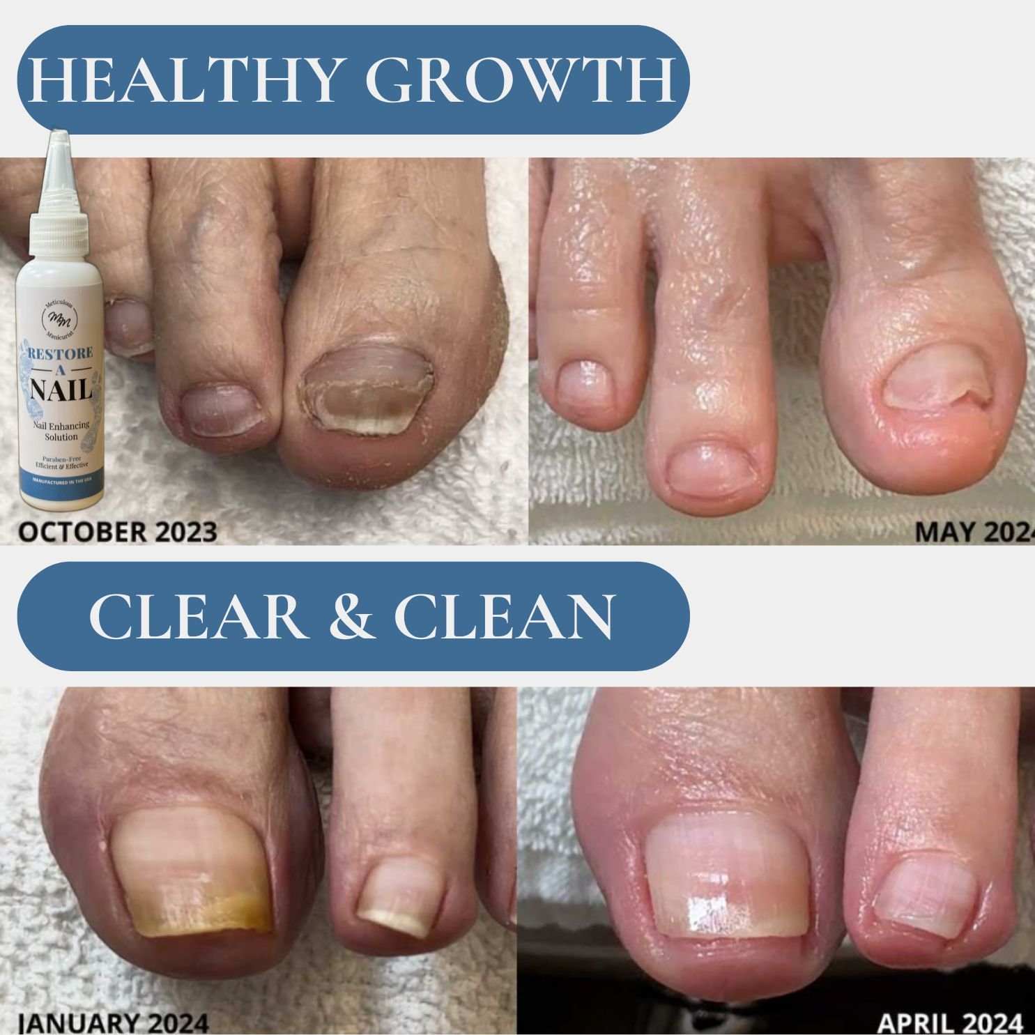 RestoreANail Healthy growth and clear skin.jpg
