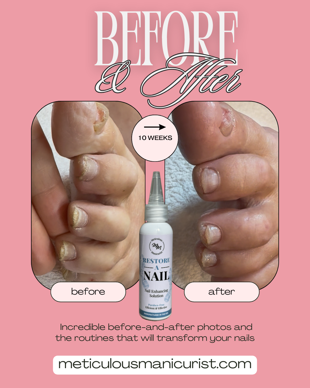 damaged toenails fix.png