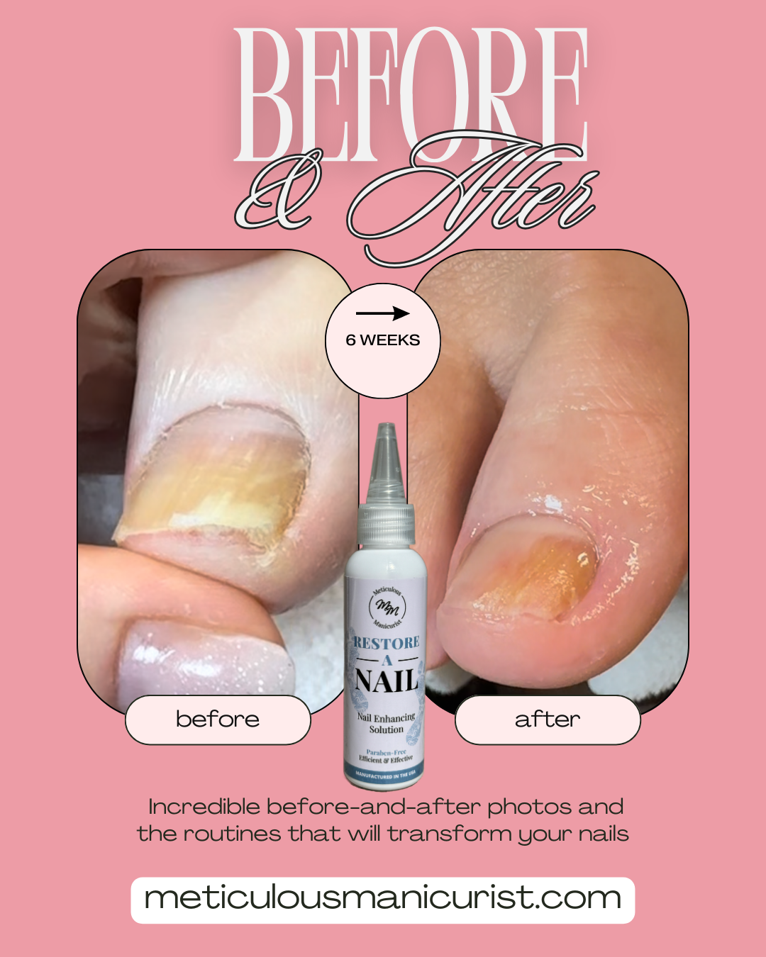 yellow toenail fix.png