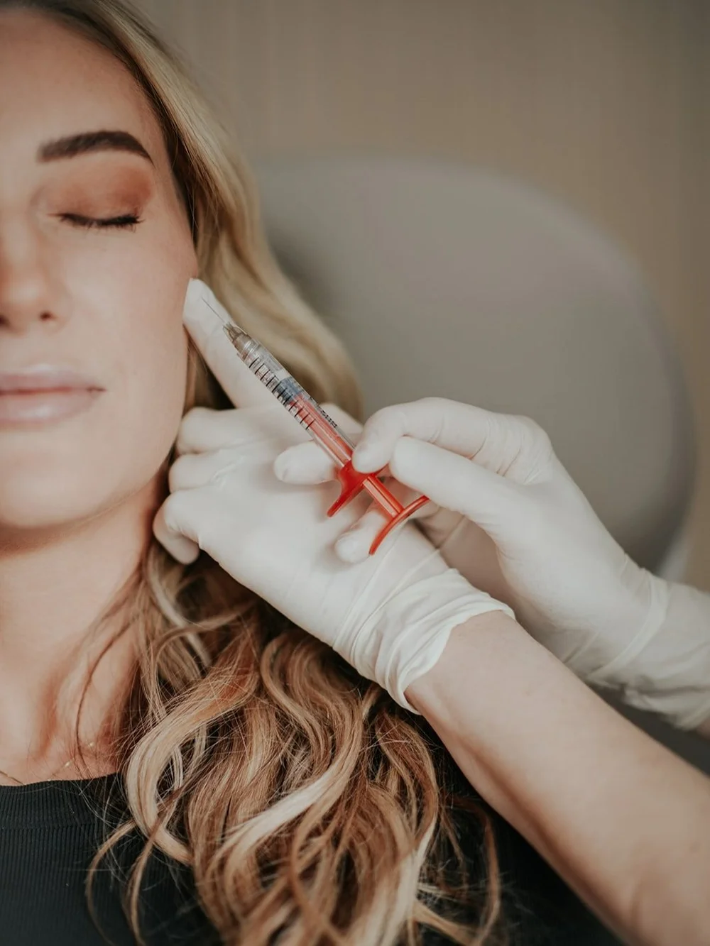 Dermal Filler (RHA, Restylane & Juvederm) — Lux Aesthetics