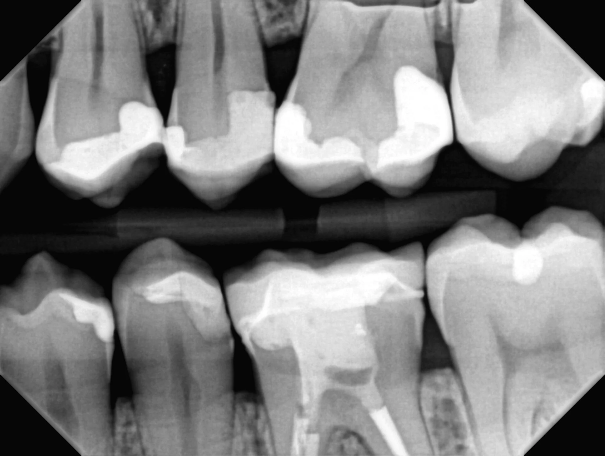 Dis-Ability is Power