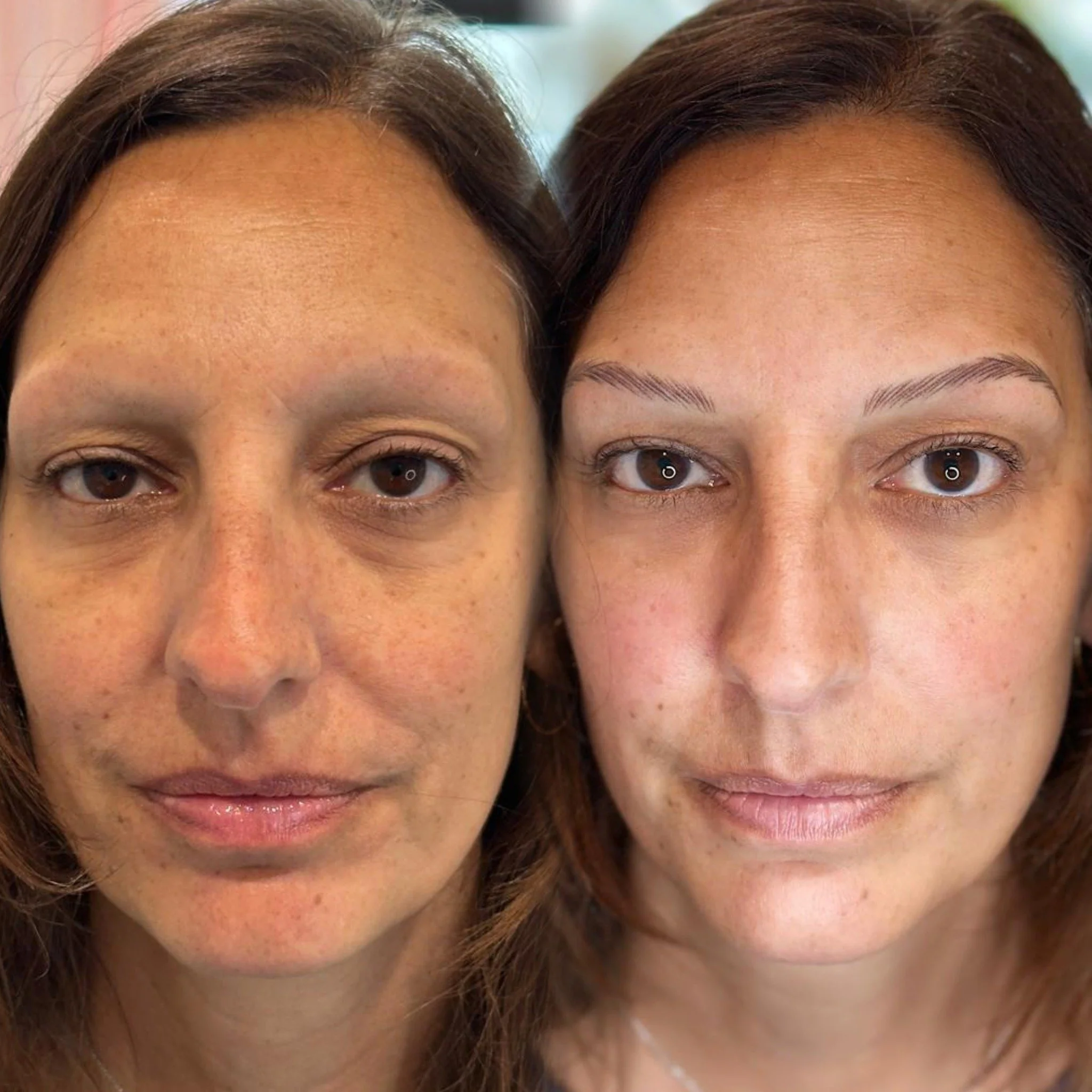 She walked in with no brow hair at all&hellip;
and walked out with nano machine strokes that look like they&rsquo;ve always been there.
Soft, natural, and totally hers.
#NanoMachineStrokes #NanoBrows #NoBrowHair #NiUBrows #SyossetBrows