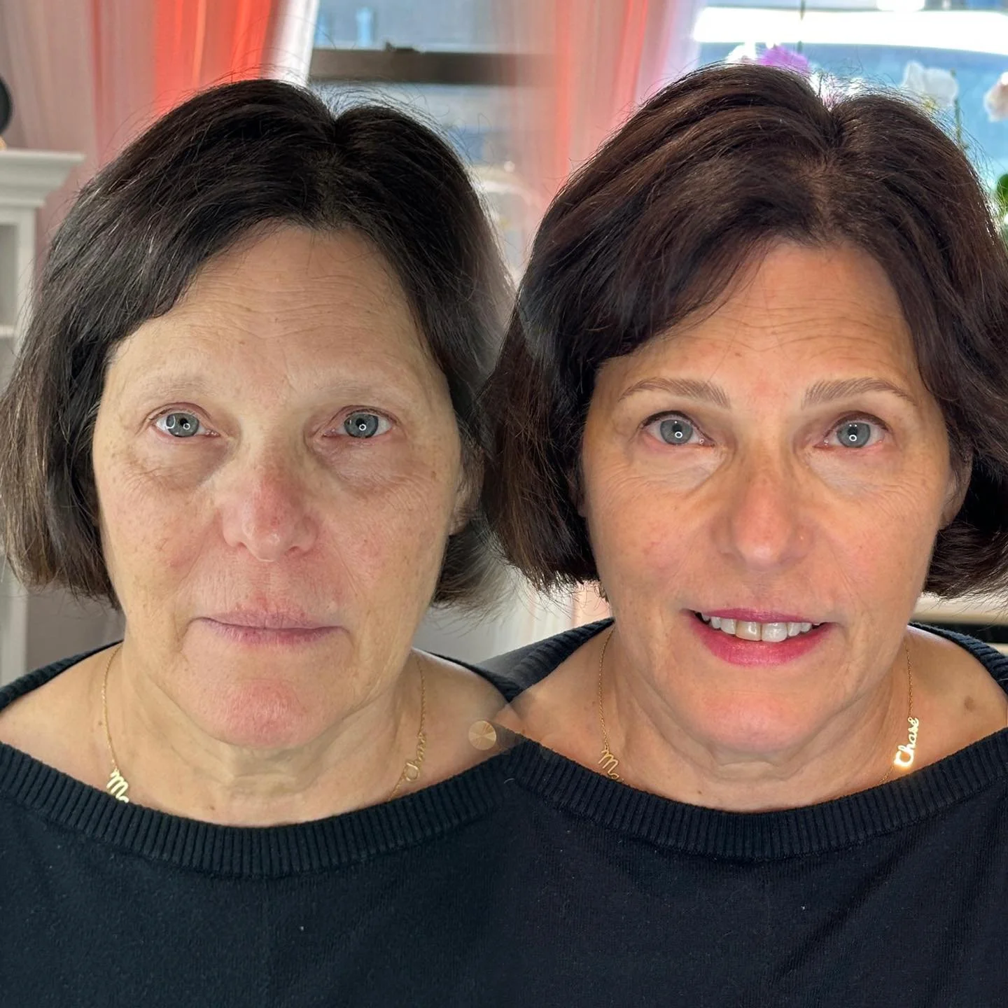 Soft, natural hair-like strokes to add gentle fullness and shape.
Perfect for keeping your brows looking real and seamless &mdash; just enhanced.

We focused on giving her brows more structure and lift while still keeping the natural texture and soft