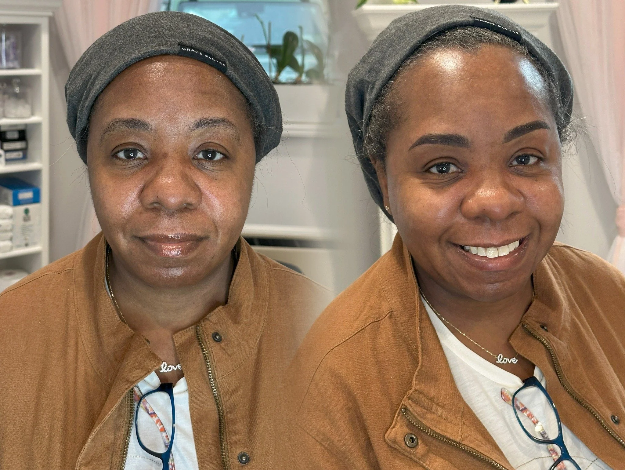 Soft &amp; Stunning Brows ✨
#PowderBrows #niubrows #syosset #PMU #BrowTransformation #beforeandafter