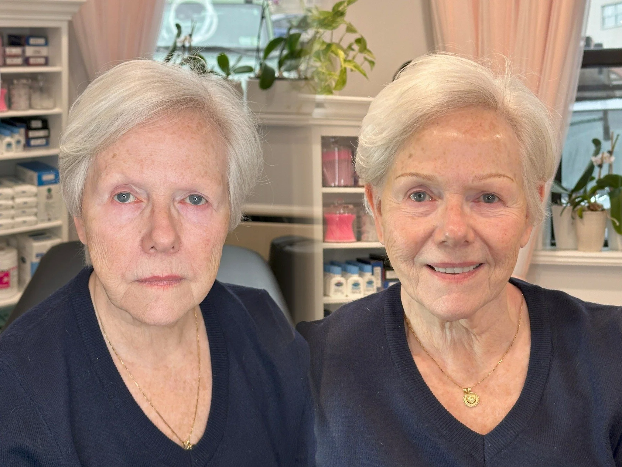 Nano Machine Strokes

 #niubrows #syossetbrows #syosset #nanobrowspmu #nanobrows #pmu