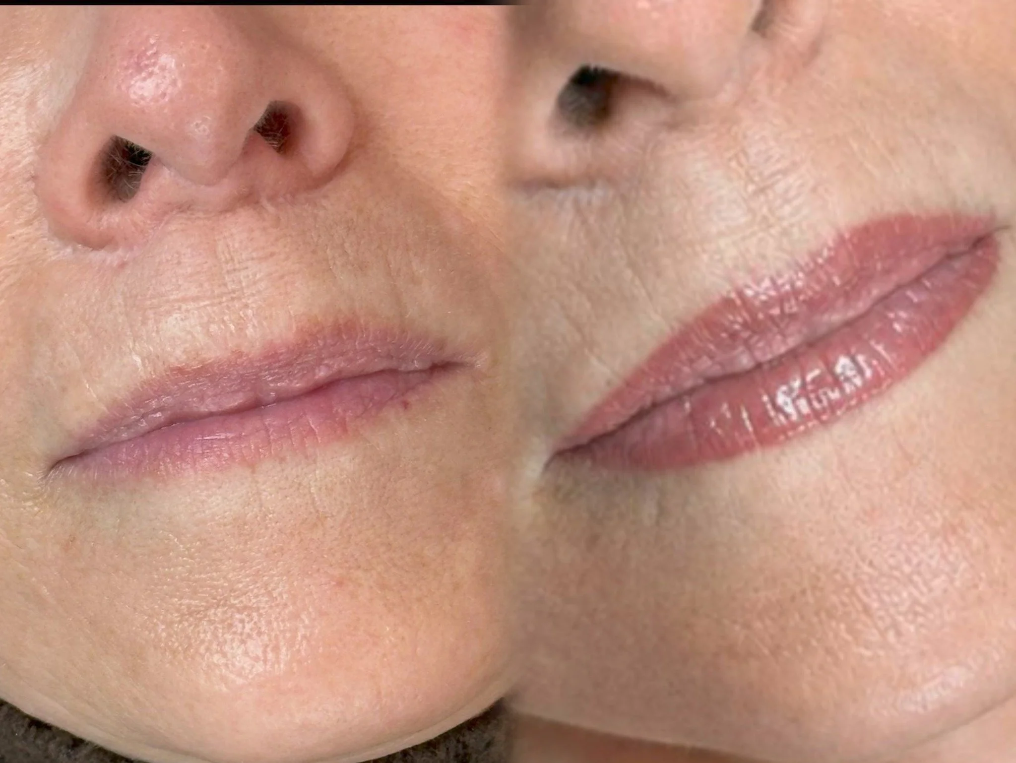 Lip blush = no lipstick, no problem.

#syossetbrows #niubrows #syosset #longisland #lipblush #pmu #beforeandafter