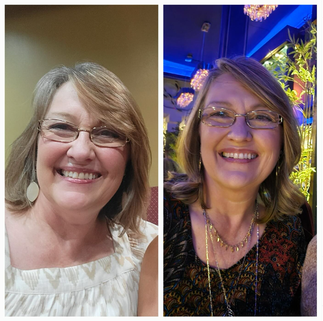 Weight Loss and improved metabolic health