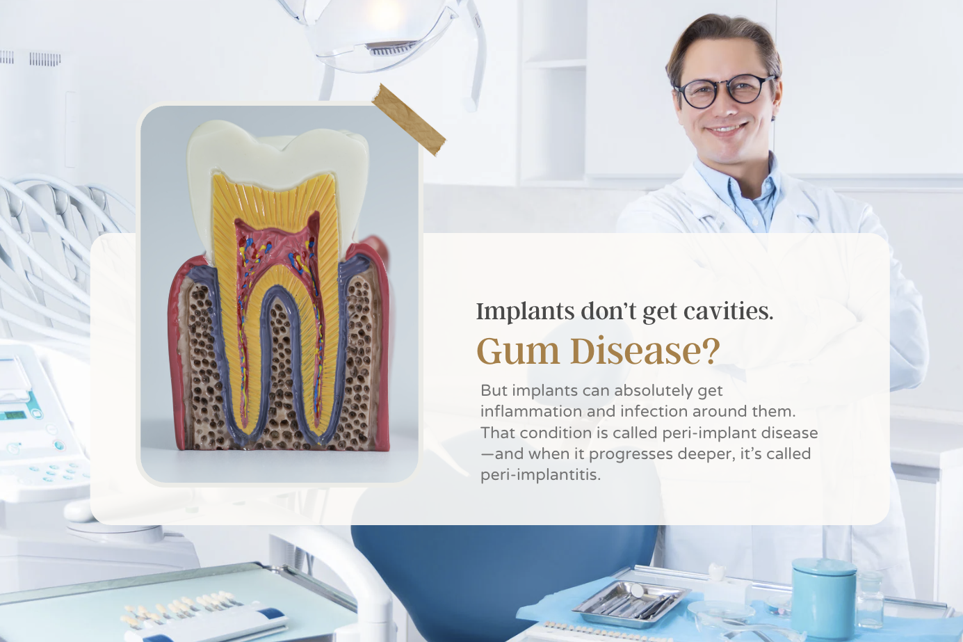 Can Dental Implants Get Gum Disease?