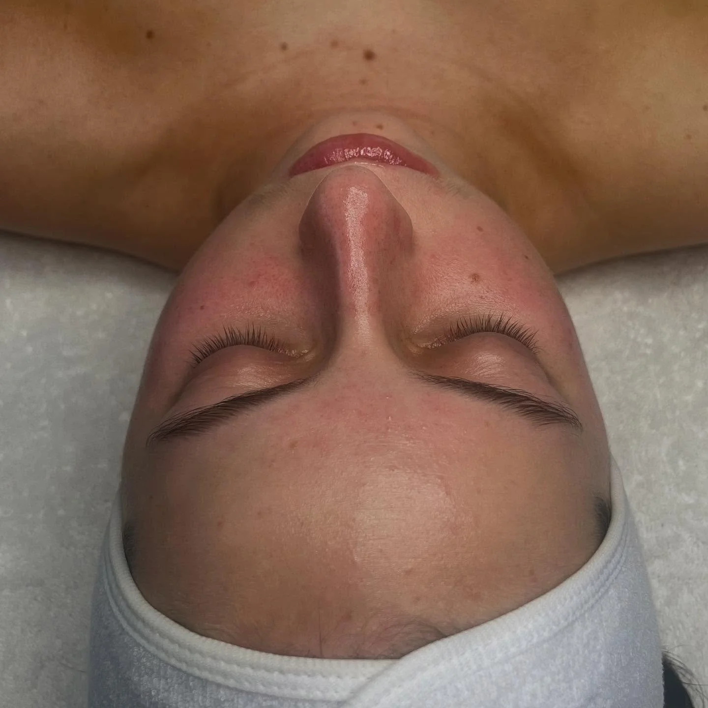 Skin in distress? We&rsquo;ve got you.
This treatment targeted congestion, dullness, and sensitivity &mdash; restoring balance and glow in under 60 minutes. ✨
Let&rsquo;s get your skin back on track!
#mtl #montrealskinexpert #skincare #facials #rives