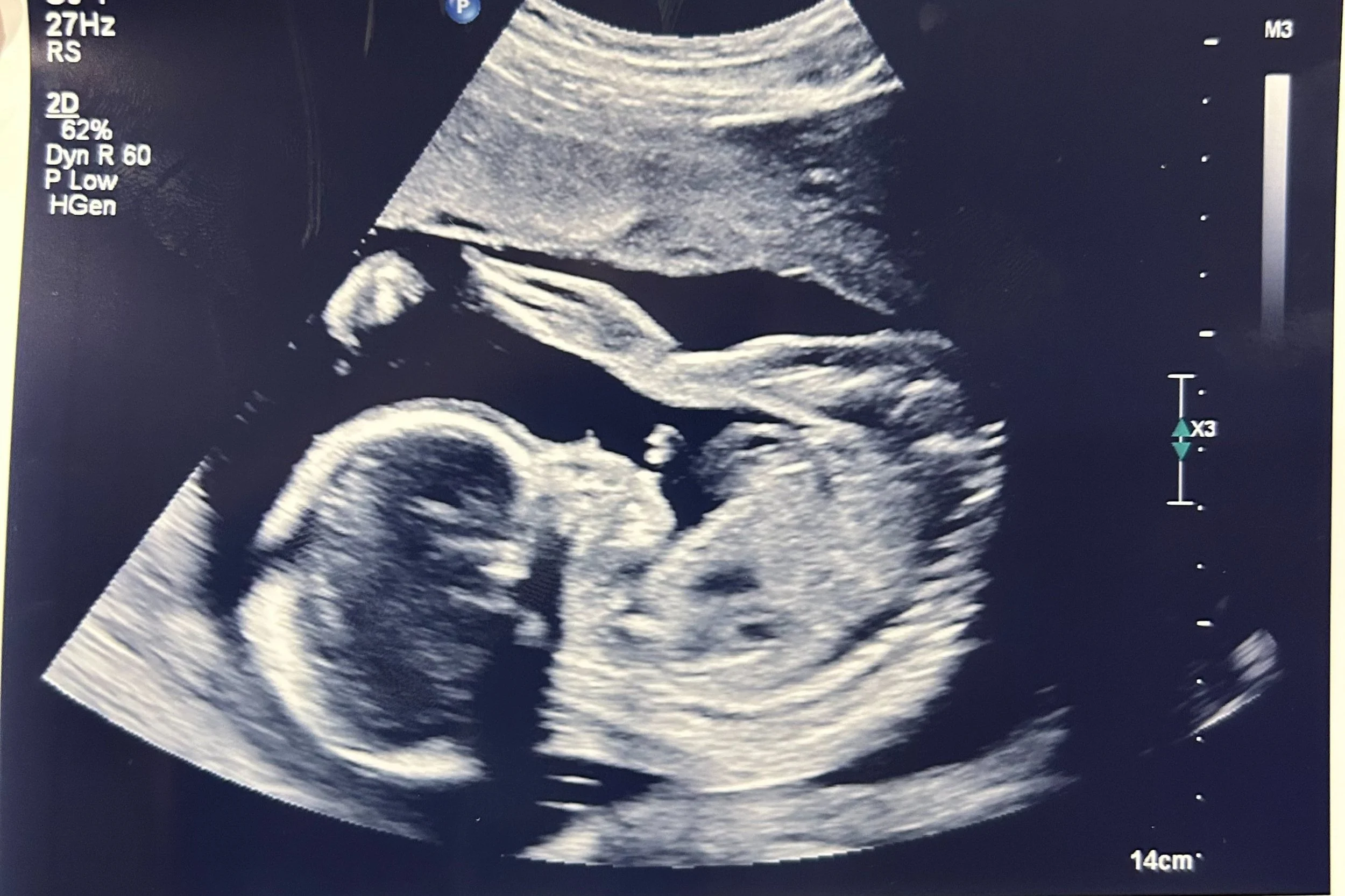 Embracing the Unknown: My Journey into Motherhood