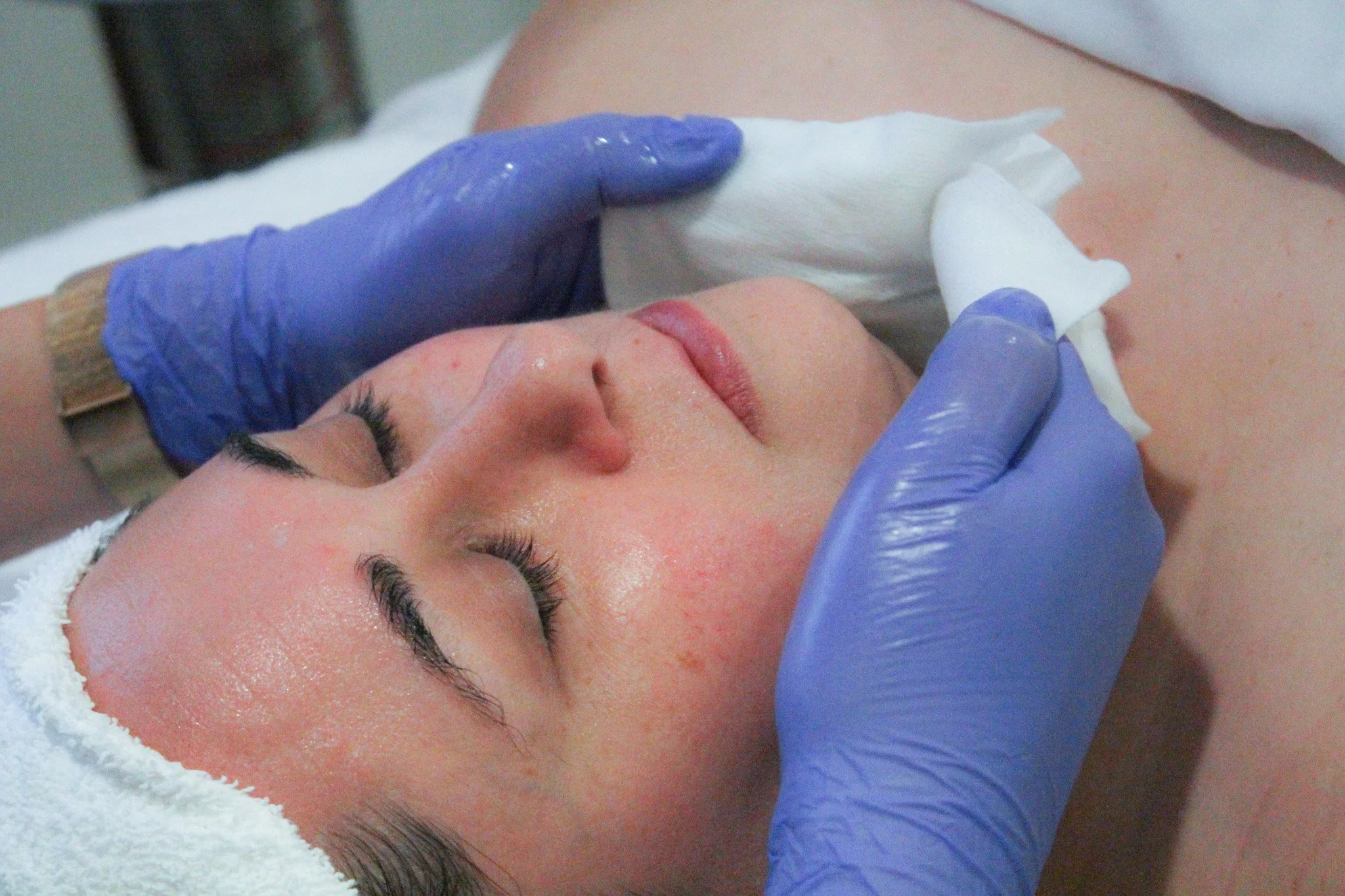 What is a Facial?