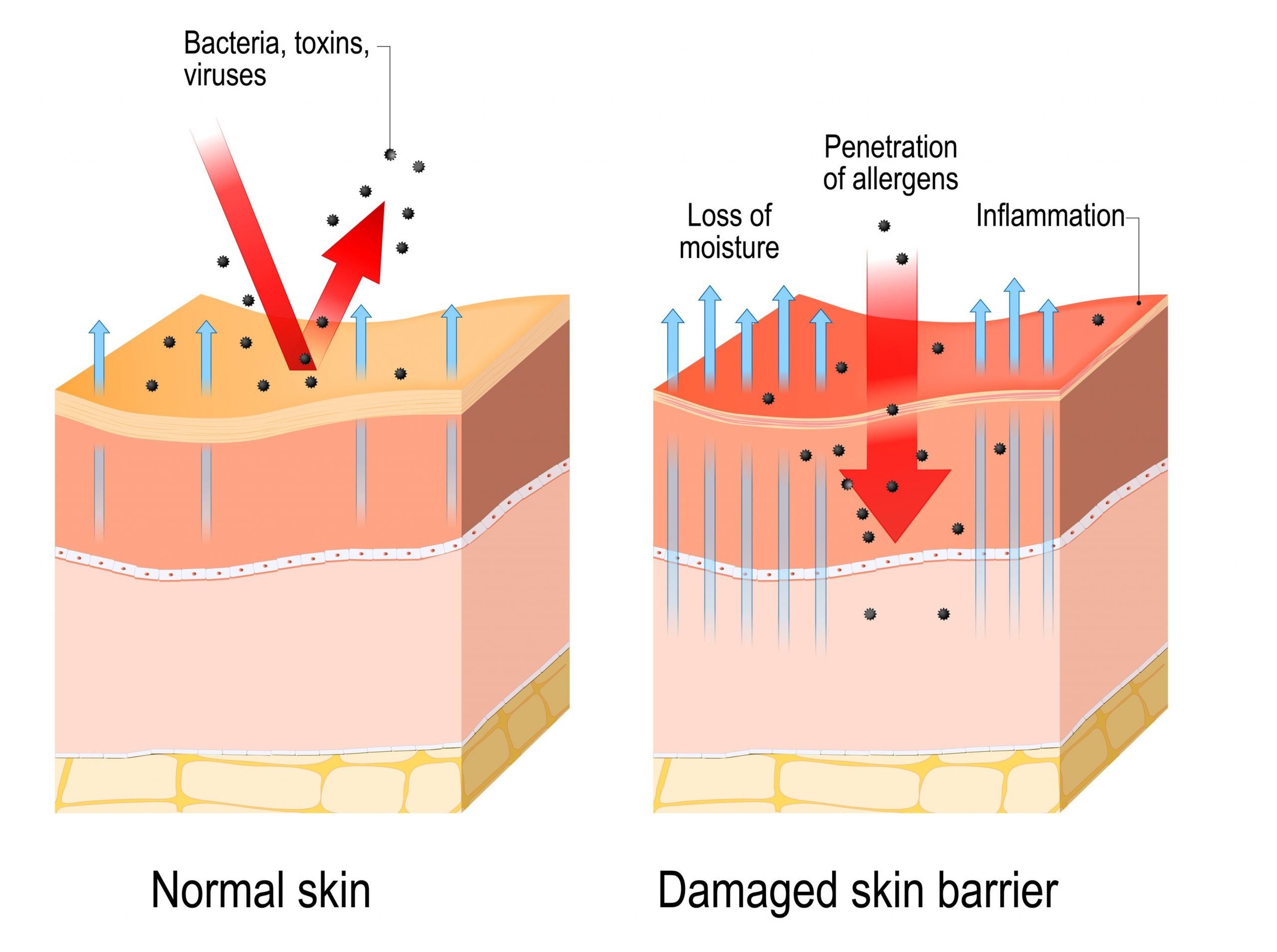 mpls skin