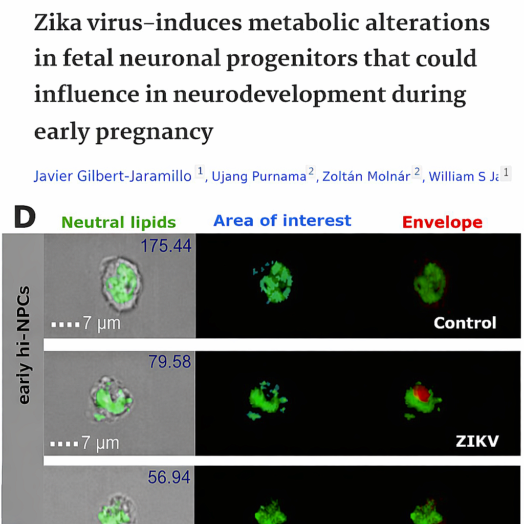 Zika virus-induces metabolic alterations in fetal neuronal progenitors that could influence in neurodevelopment during early pregnancy