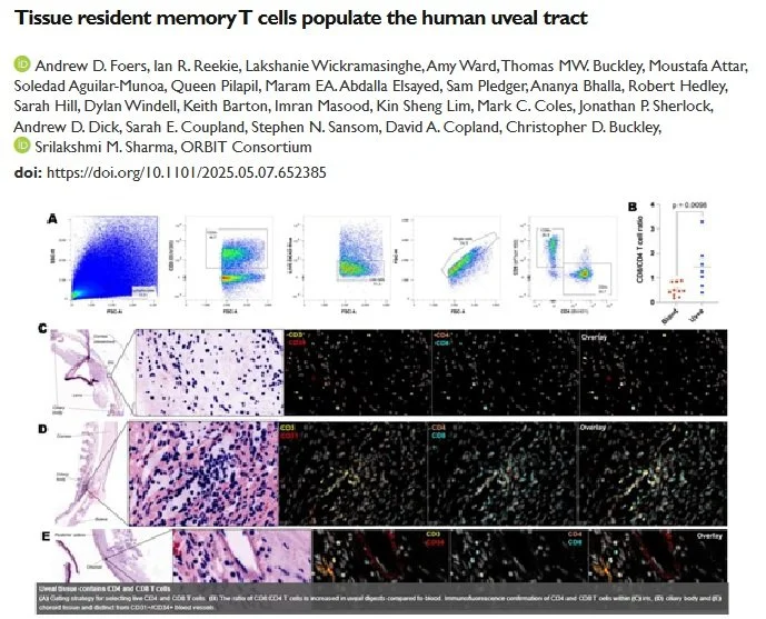 Tissue resident memory T cells populate the human uveal tract