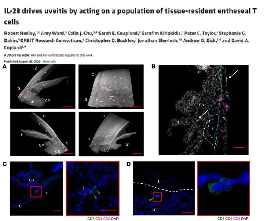 IL-23 drives uveitis by acting on a population of tissue-resident entheseal T cells