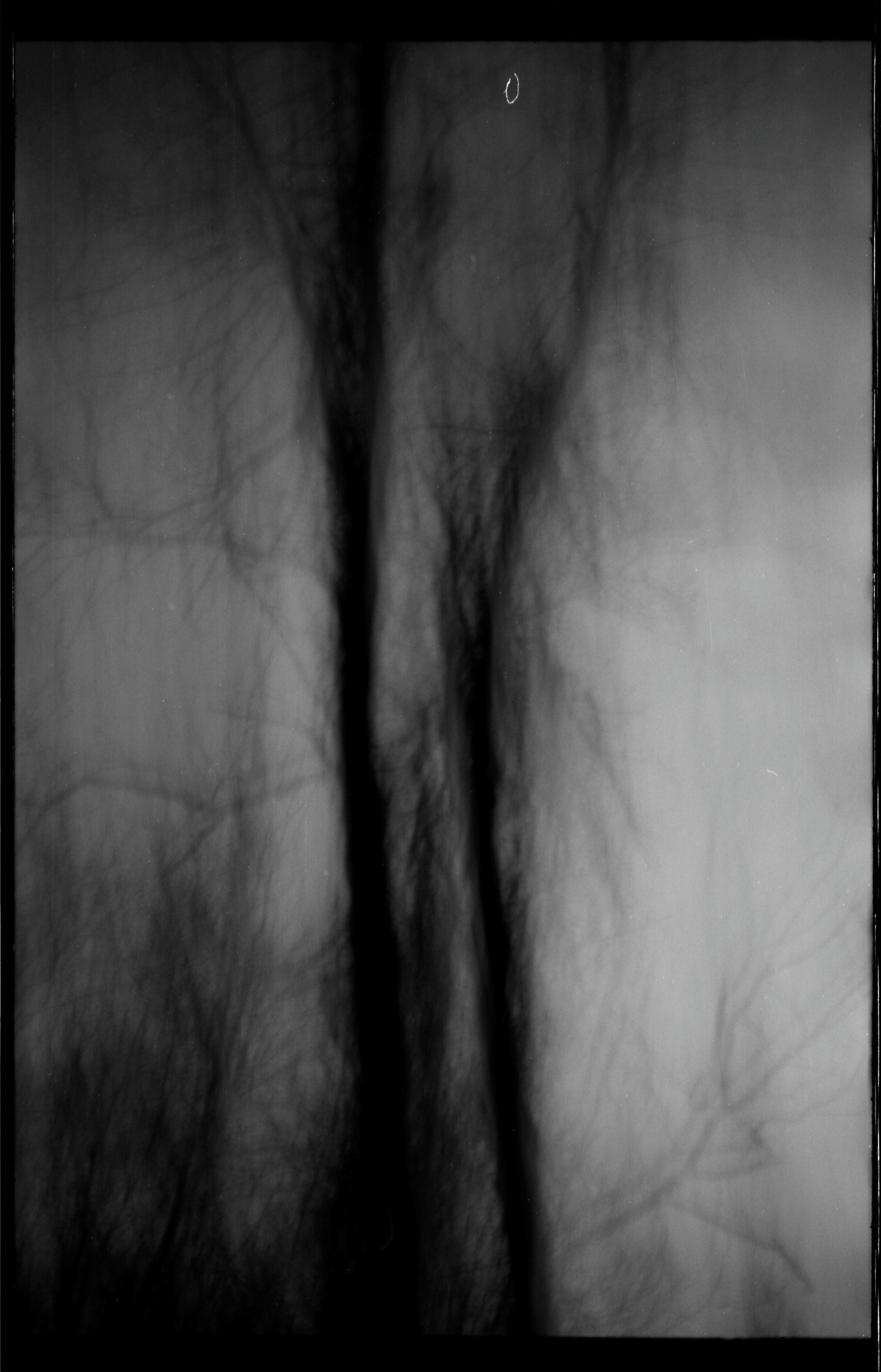 "Tanglewood"
