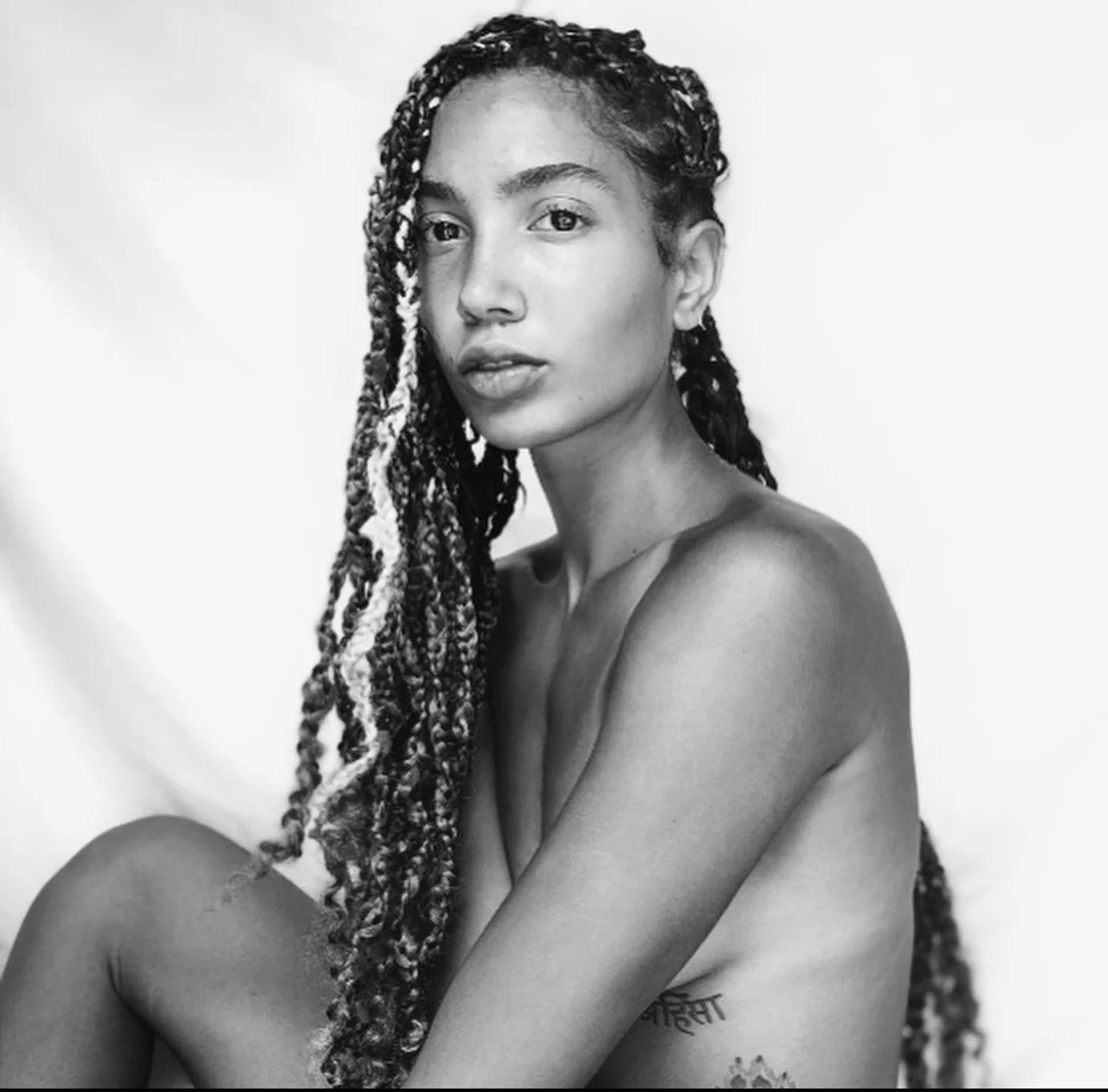 Overcoming Body- Dyspmorphia and Loving Who You Are 