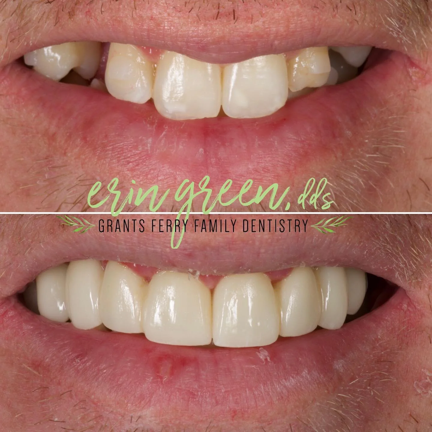 Dental Clinic - Family Dentistry in Brandon, MS | Grants Ferry Dentistry