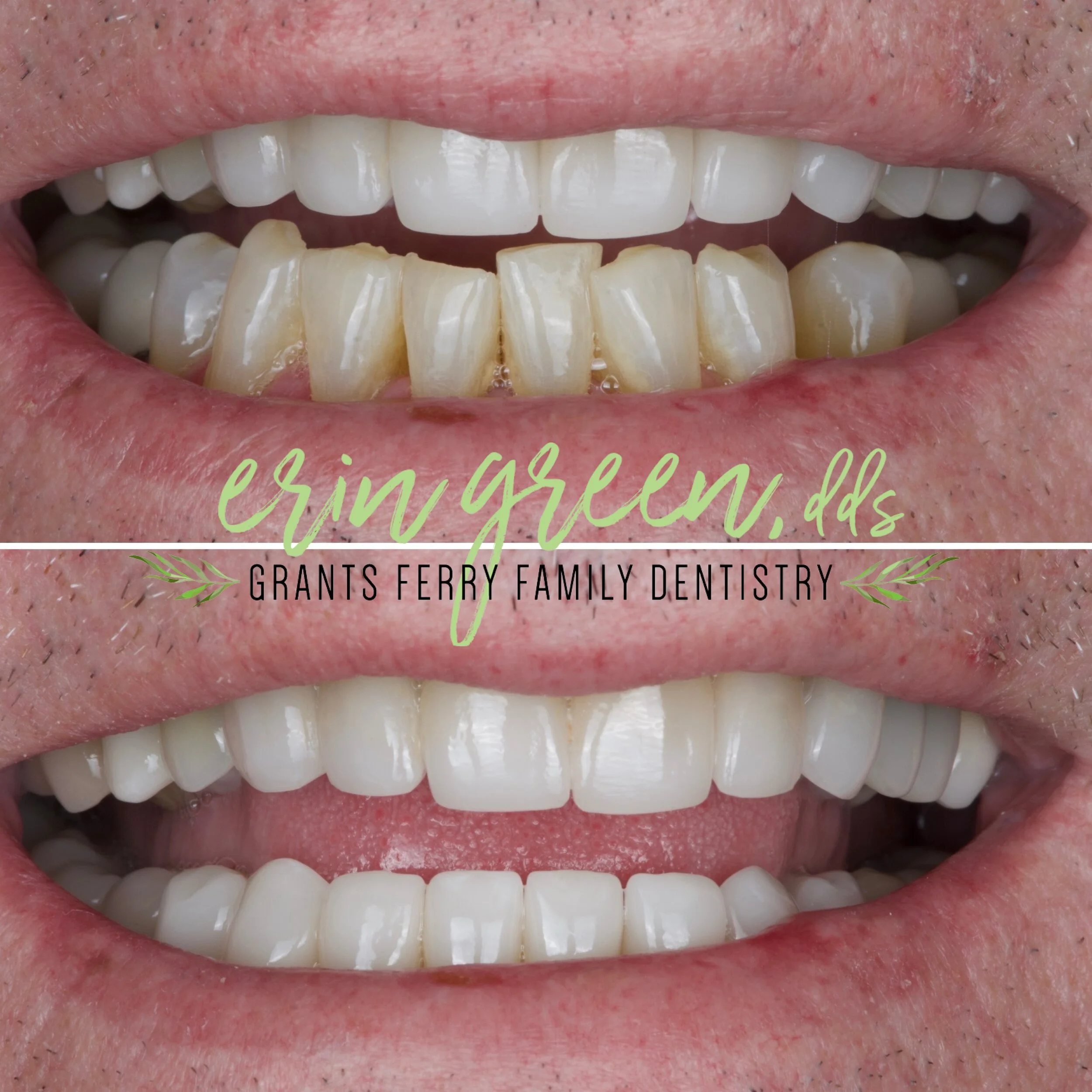 Family Dental Clinic in Brandon, MS Grants Ferry Dentistry