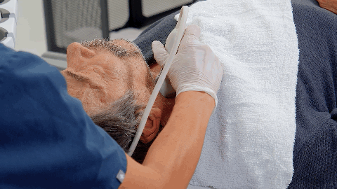 Carotid duplex ultrasound image