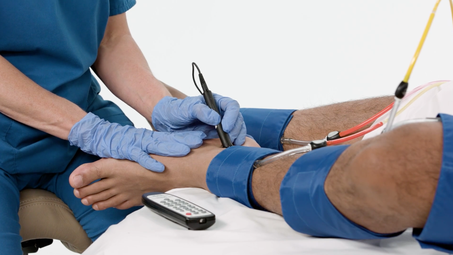 ABI PVR physiologic testing image
