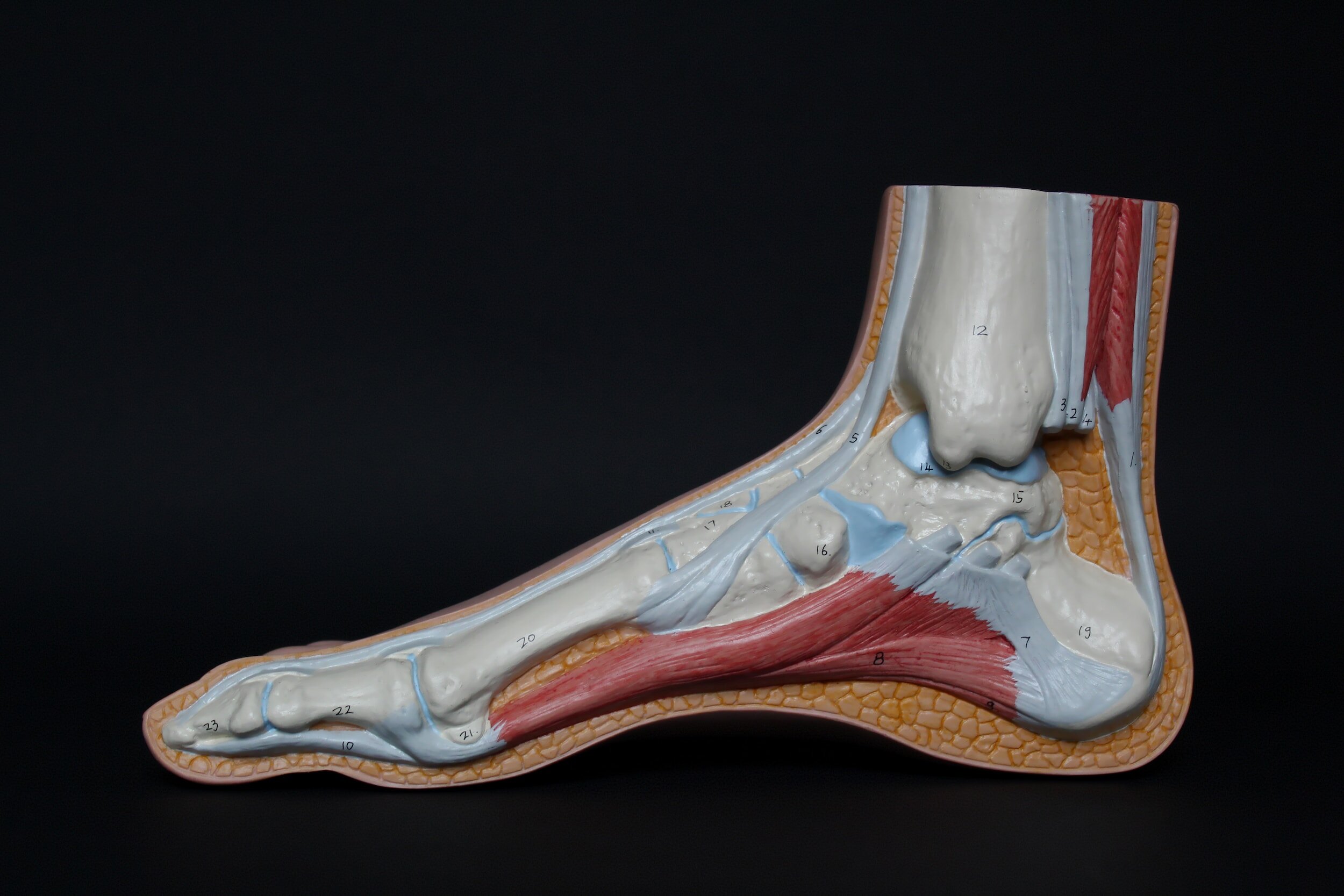 Achilles tendon injuries