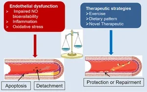 Редуциране на атеросклеротична плака
