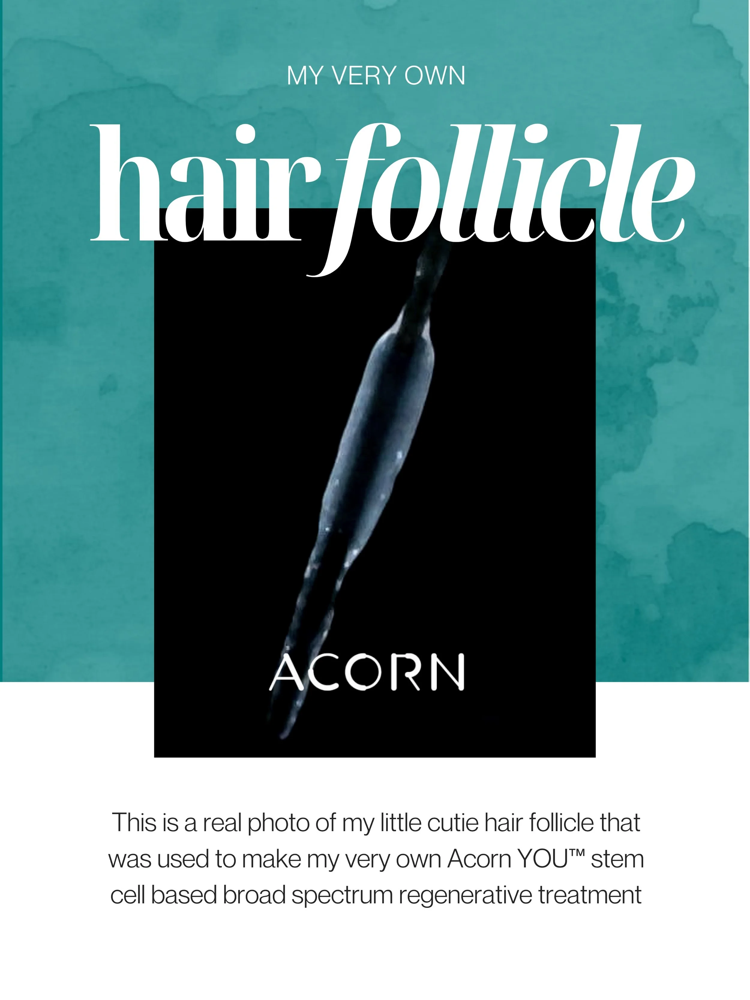 This is a real photo of the hair follicle used to make my personalized @acornbiolabs YOU&trade;  Secretome Treatment&mdash;and honestly, she&rsquo;s kind of adorable!

My secretome treatment vials are packed with 550+ components made by MY hair folli