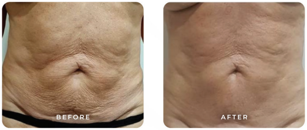 Screenshot 2026-01-15 at 11.02.38 AM.png