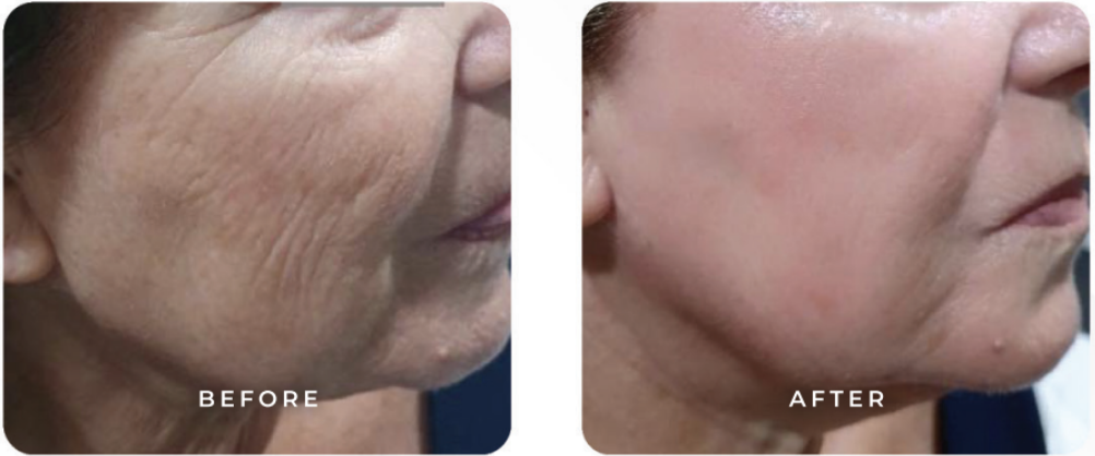 Screenshot 2026-01-15 at 11.02.48 AM.png