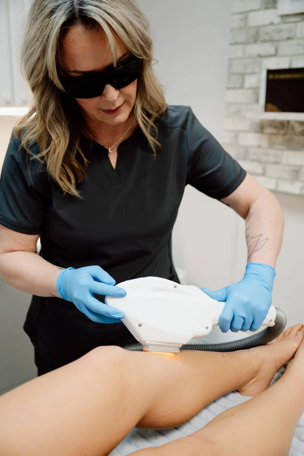 A woman wearing black scrubs, sunglasses, and blue gloves performing a medical procedure using a laser device on a patient's leg in a clinical setting.