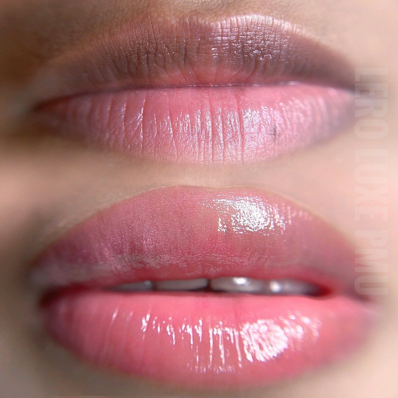 Dark Lips Neutralization — Lero Luxe PMU