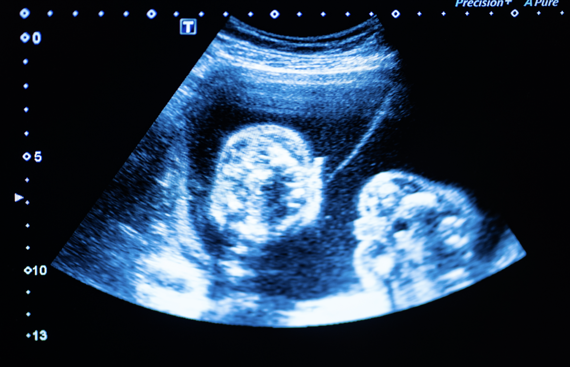 The Maternal Health Crisis in Texas: Visibility, Access, and Systemic Failure