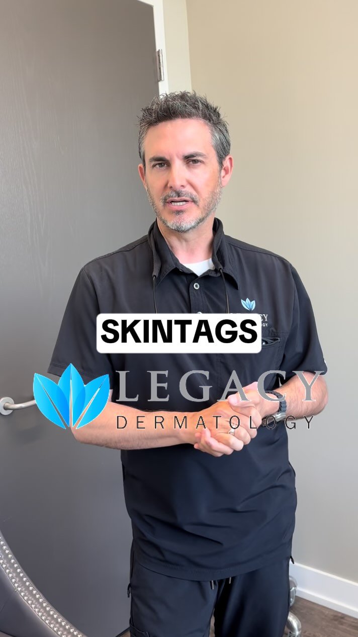 Have a skin tag you’ve been curious about? You’ve got options!
#skintags #dermatologist #utah