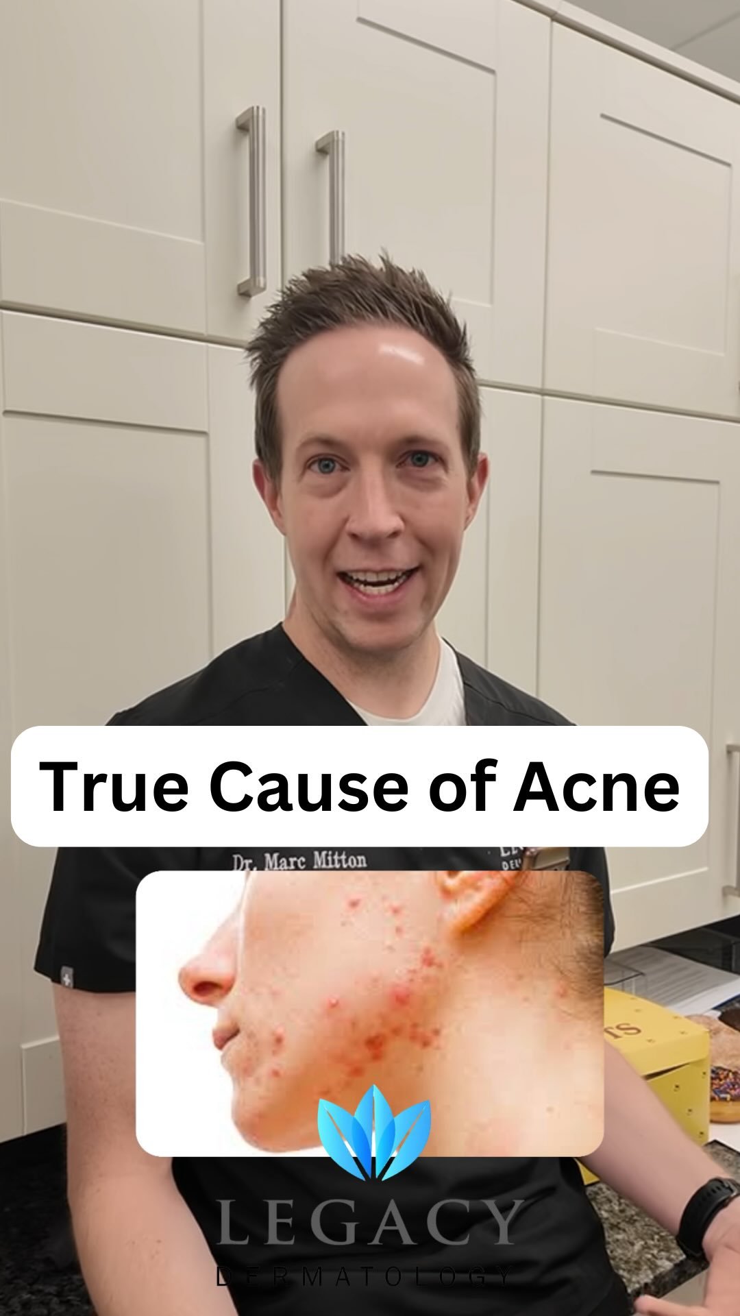 Many myths around what causes acne. The truth might surprise you.
#acne #skincare