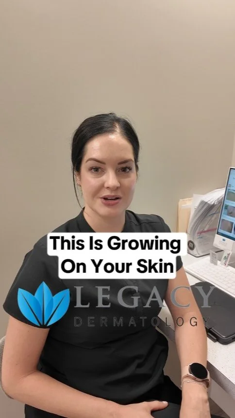 This is what’s growing on your skin!๐ฌ #skincare #dermatologist