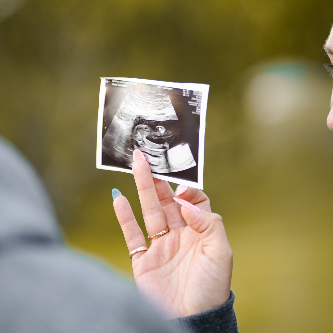 What's Missing in Most Conventional Preconception Prep?