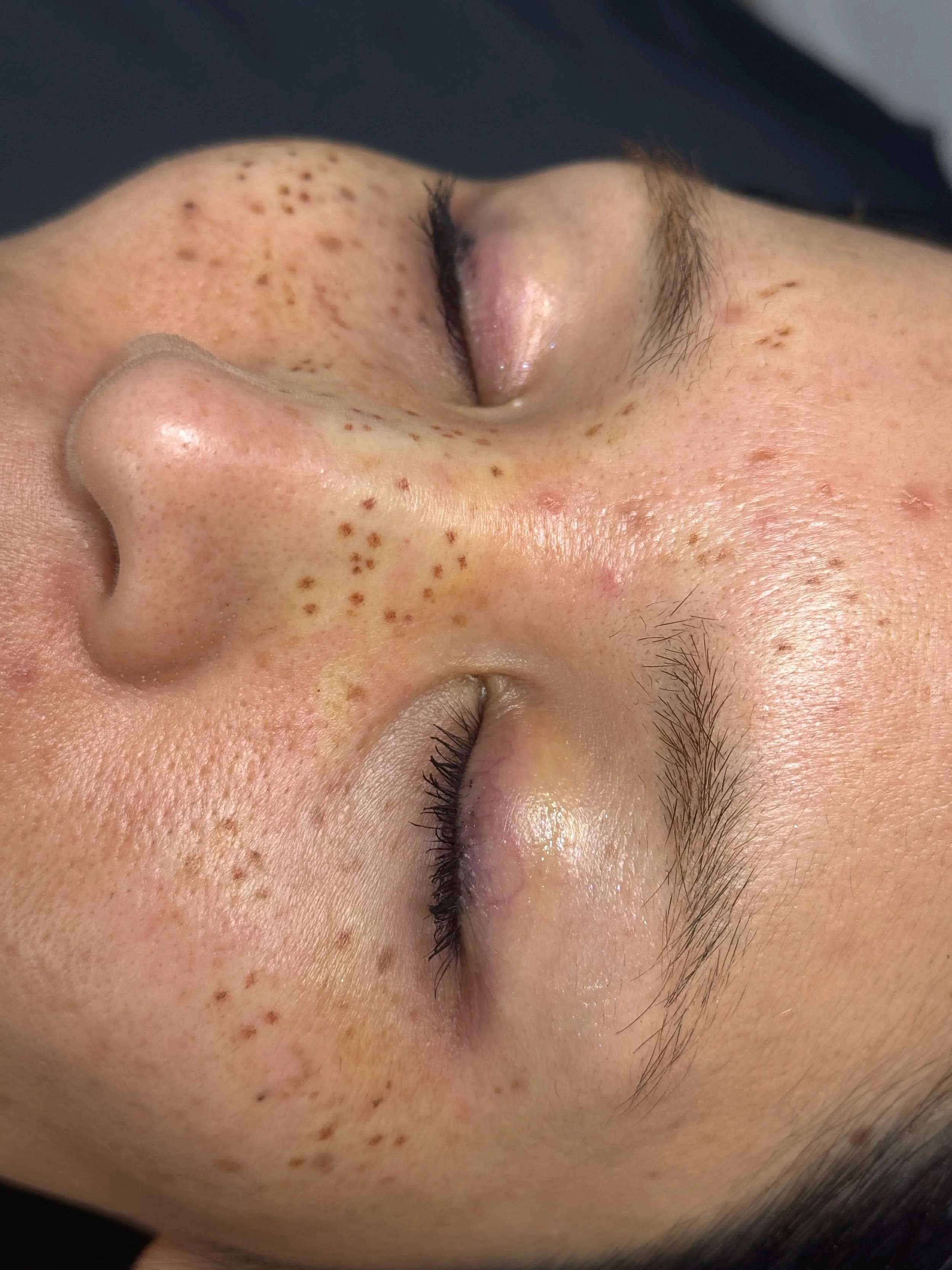 Close-up of a person's face with visible freckles, freckles on the nose and cheeks, closed eyes, and slightly arched eyebrows.